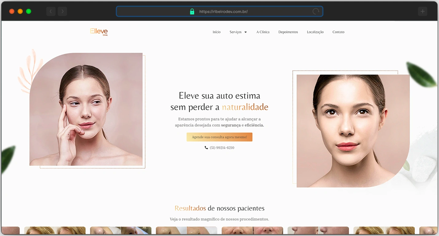 pagina_elleve_clinic